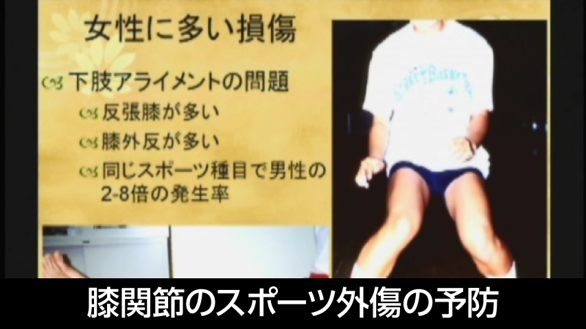 膝関節のスポーツ外傷の予防