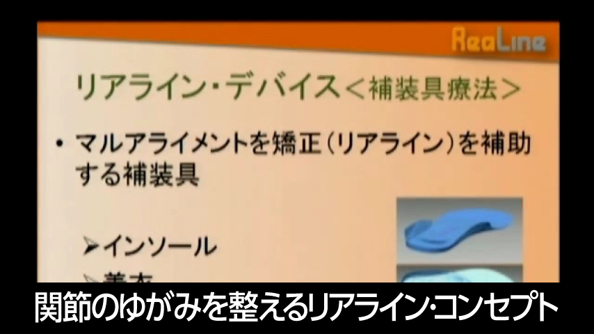 アスリートから高齢者まで関節のゆがみを整える「リアライン・コンセプト」下肢編
