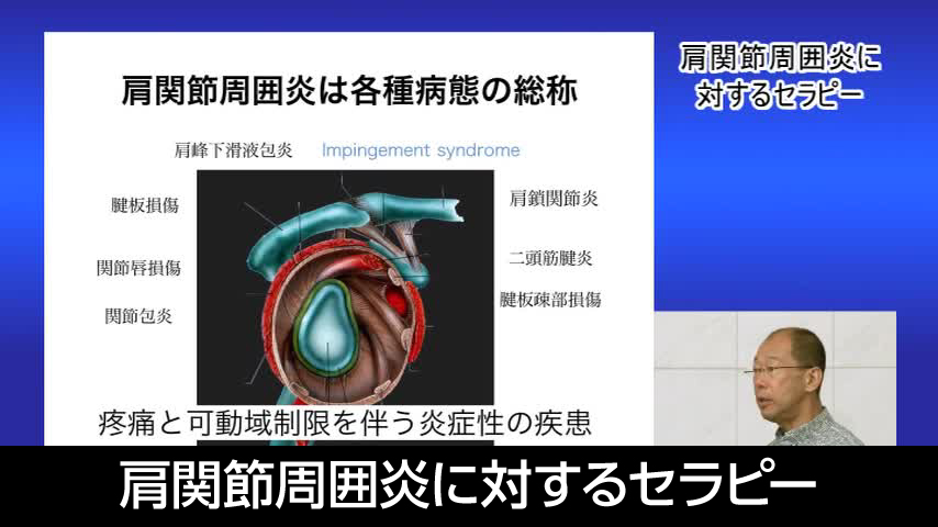 肩関節周囲炎に対するセラピー